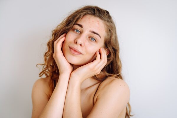 Acne Clarifying Face Wash - Image 2